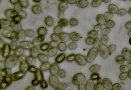 Yeast and bacteria in kombucha magnified 400 times